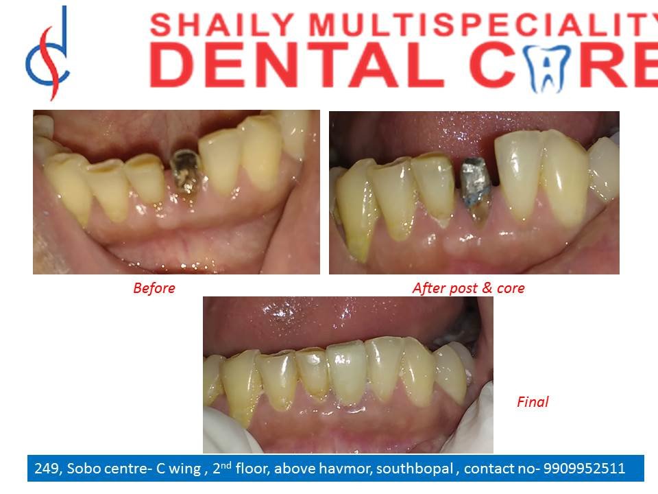 Shaily Multispeciality dental care - Shaily Multispeciality dental care