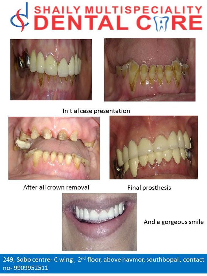 Shaily Multispeciality dental care - Shaily Multispeciality dental care