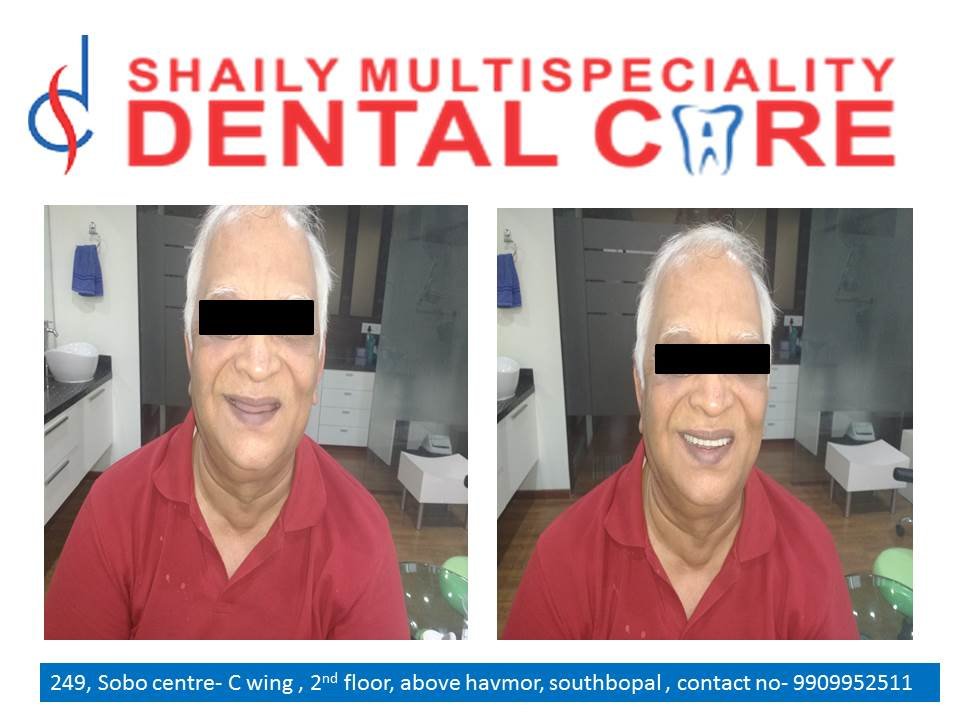 Shaily Multispeciality dental care - Shaily Multispeciality dental care