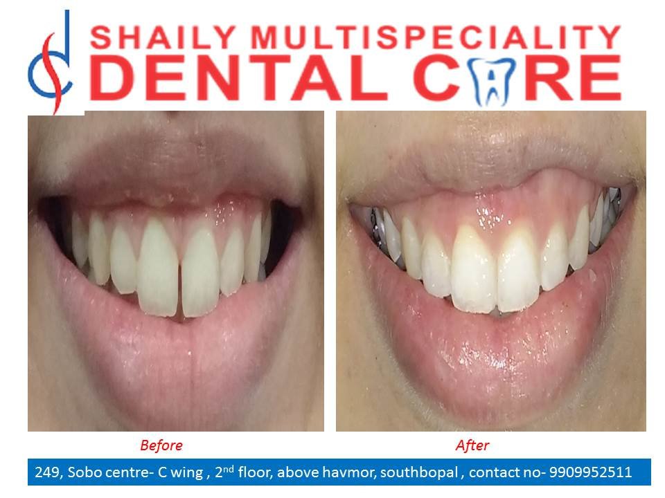 Shaily Multispeciality dental care - Shaily Multispeciality dental care