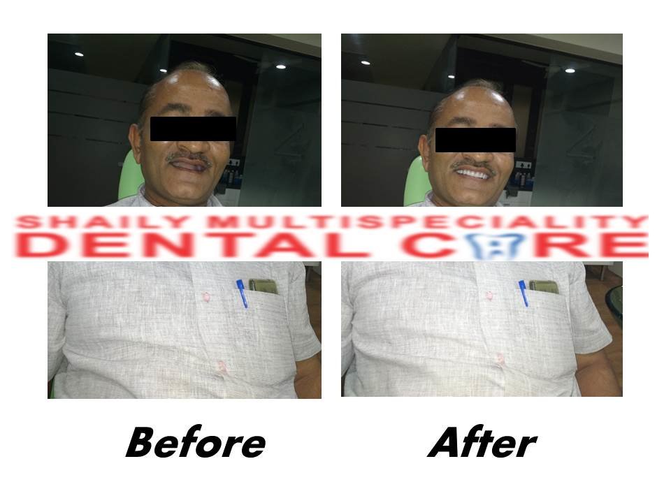 Shaily Multispeciality dental care - Shaily Multispeciality dental care