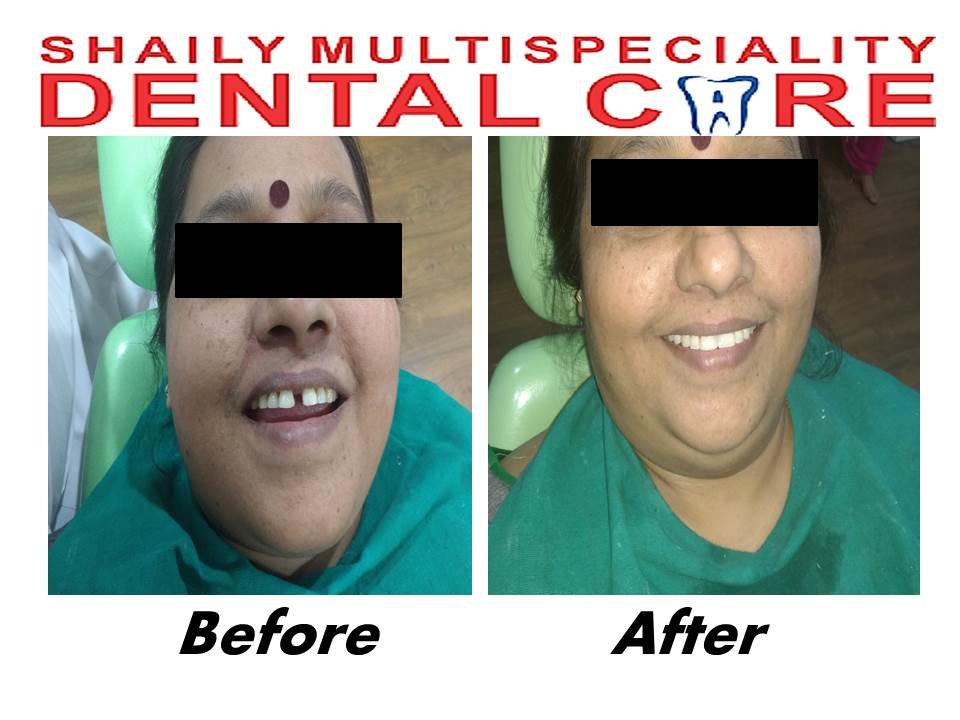 Shaily Multispeciality dental care - Shaily Multispeciality dental care