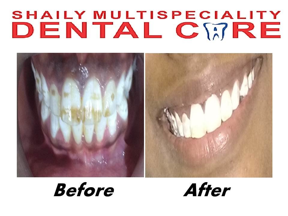 Shaily Multispeciality dental care - Shaily Multispeciality dental care