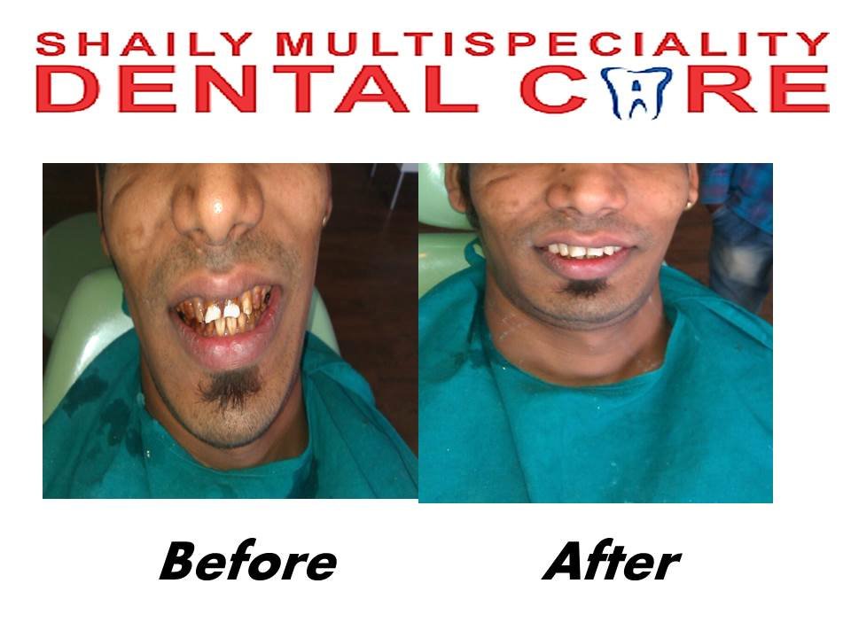 Shaily Multispeciality dental care - Shaily Multispeciality dental care