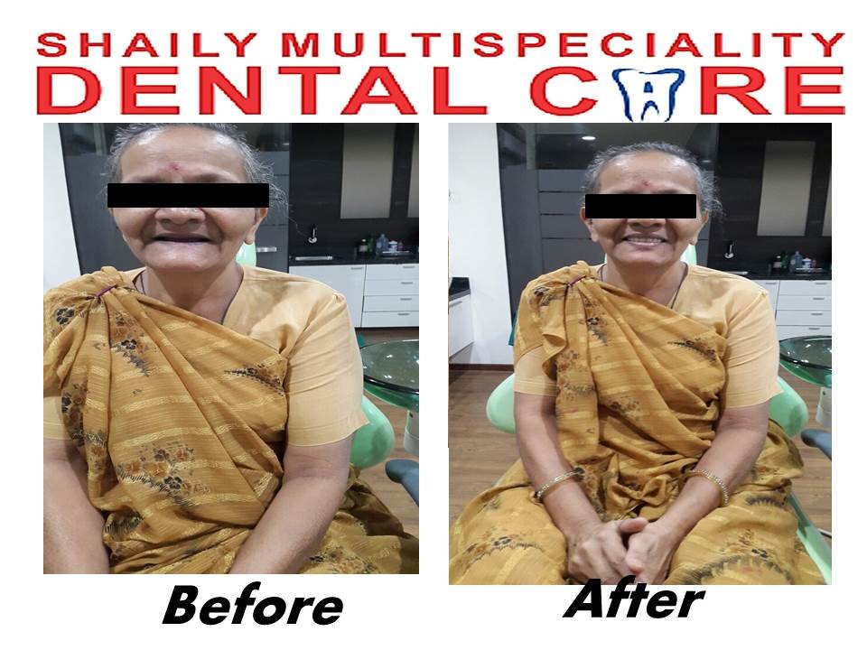 Shaily Multispeciality dental care - Shaily Multispeciality dental care