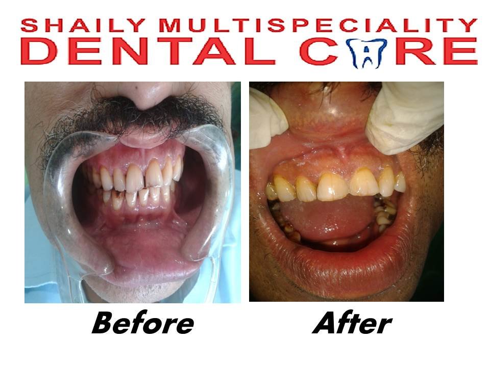 Shaily Multispeciality dental care - Shaily Multispeciality dental care