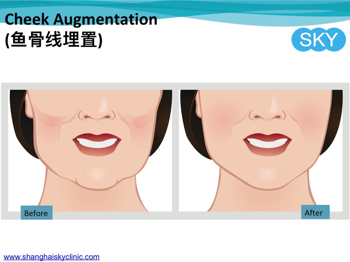 Shanghai Sky Clinic - Shanghai Sky Clinic