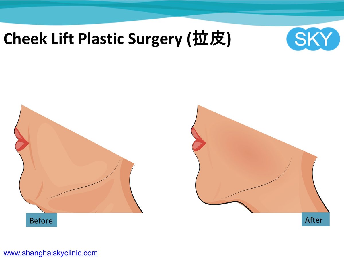 Shanghai Sky Clinic - Shanghai Sky Clinic