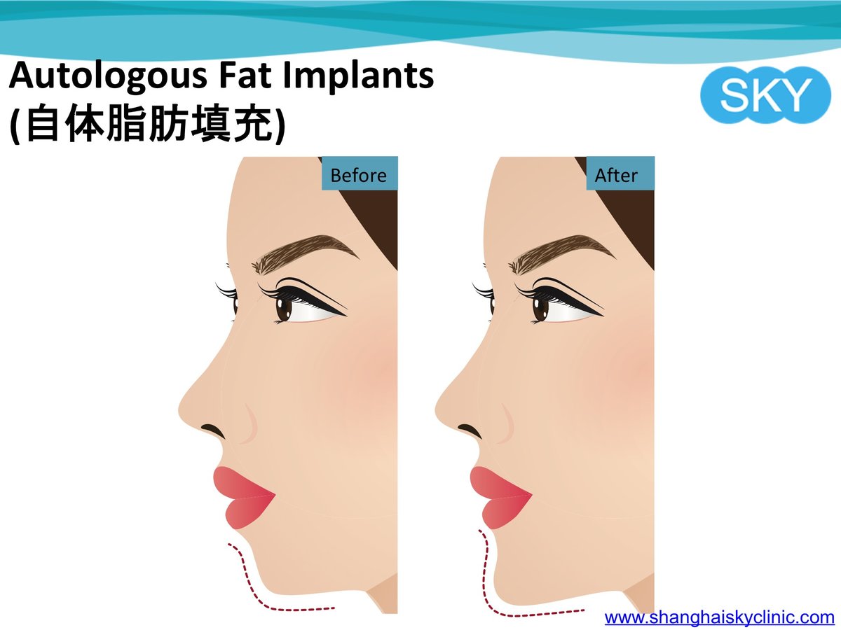 Shanghai Sky Clinic - Shanghai Sky Clinic