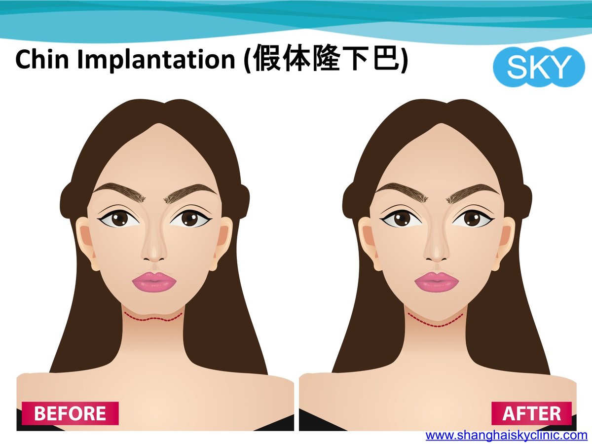 Shanghai Sky Clinic - Shanghai Sky Clinic