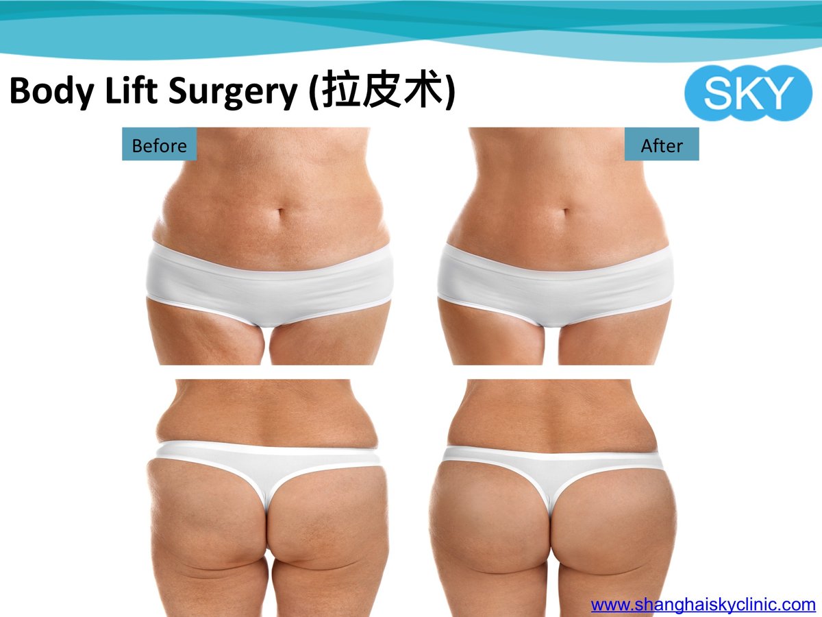 Shanghai Sky Clinic - Shanghai Sky Clinic