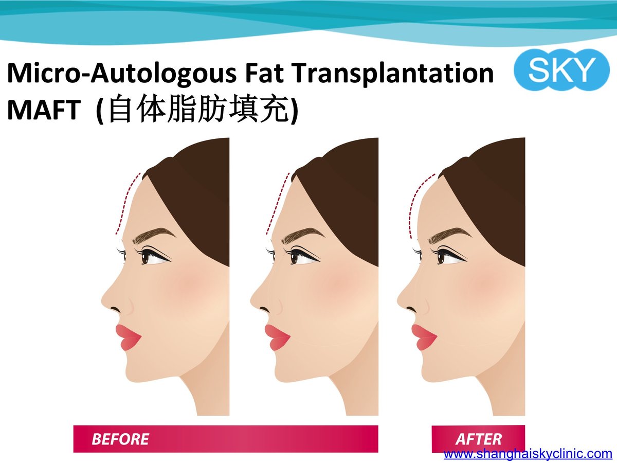 Shanghai Sky Clinic - Shanghai Sky Clinic