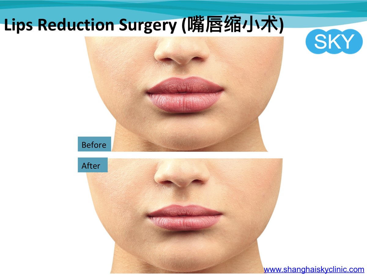 Shanghai Sky Clinic - Shanghai Sky Clinic