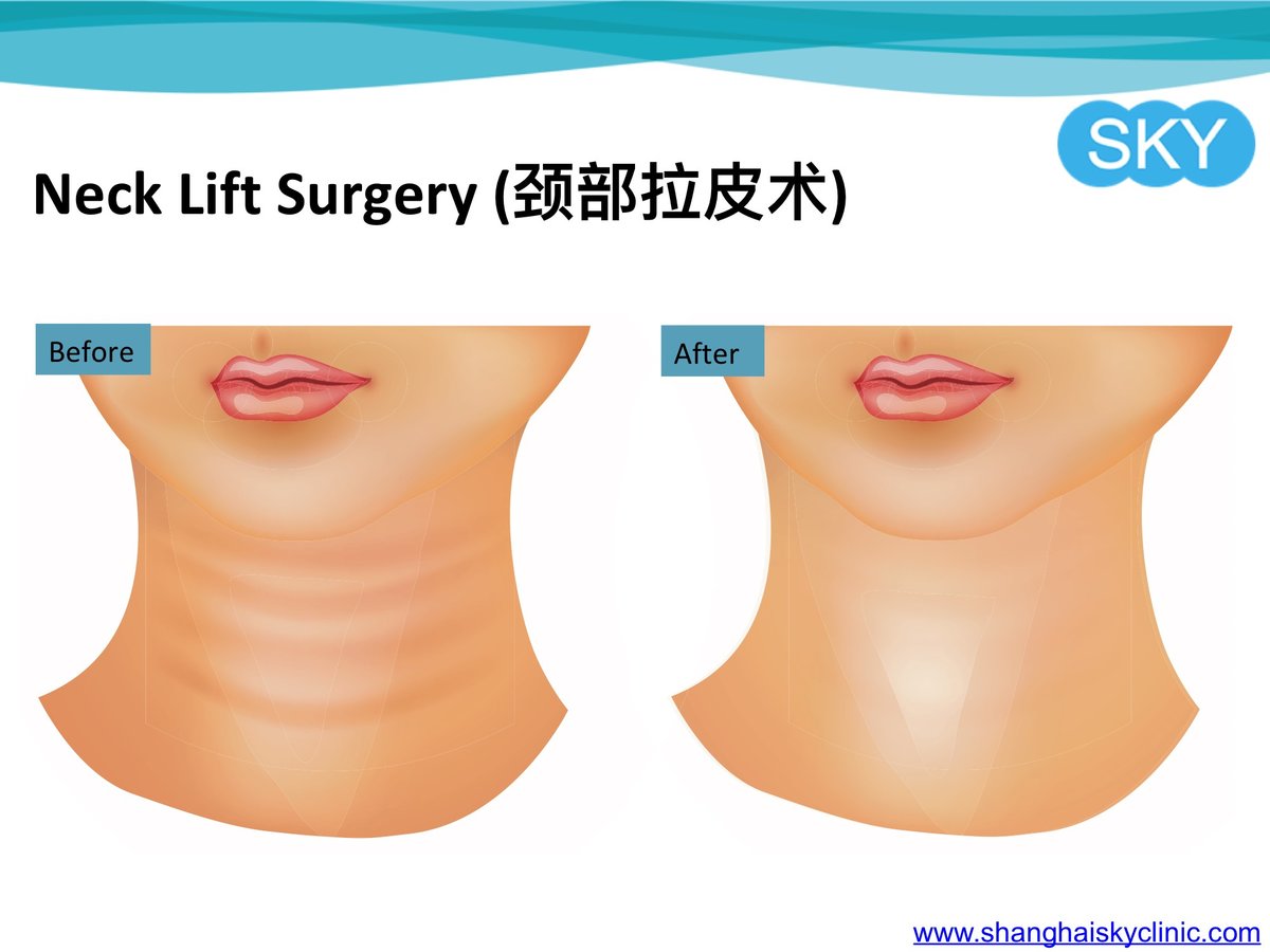 Shanghai Sky Clinic - Shanghai Sky Clinic