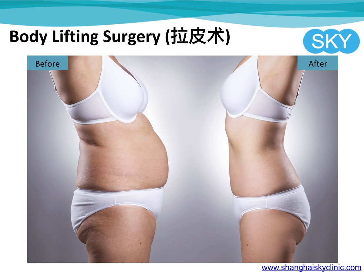 Shanghai Sky Clinic - Shanghai Sky Clinic