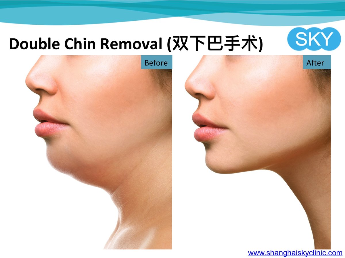 Shanghai Sky Clinic - Shanghai Sky Clinic