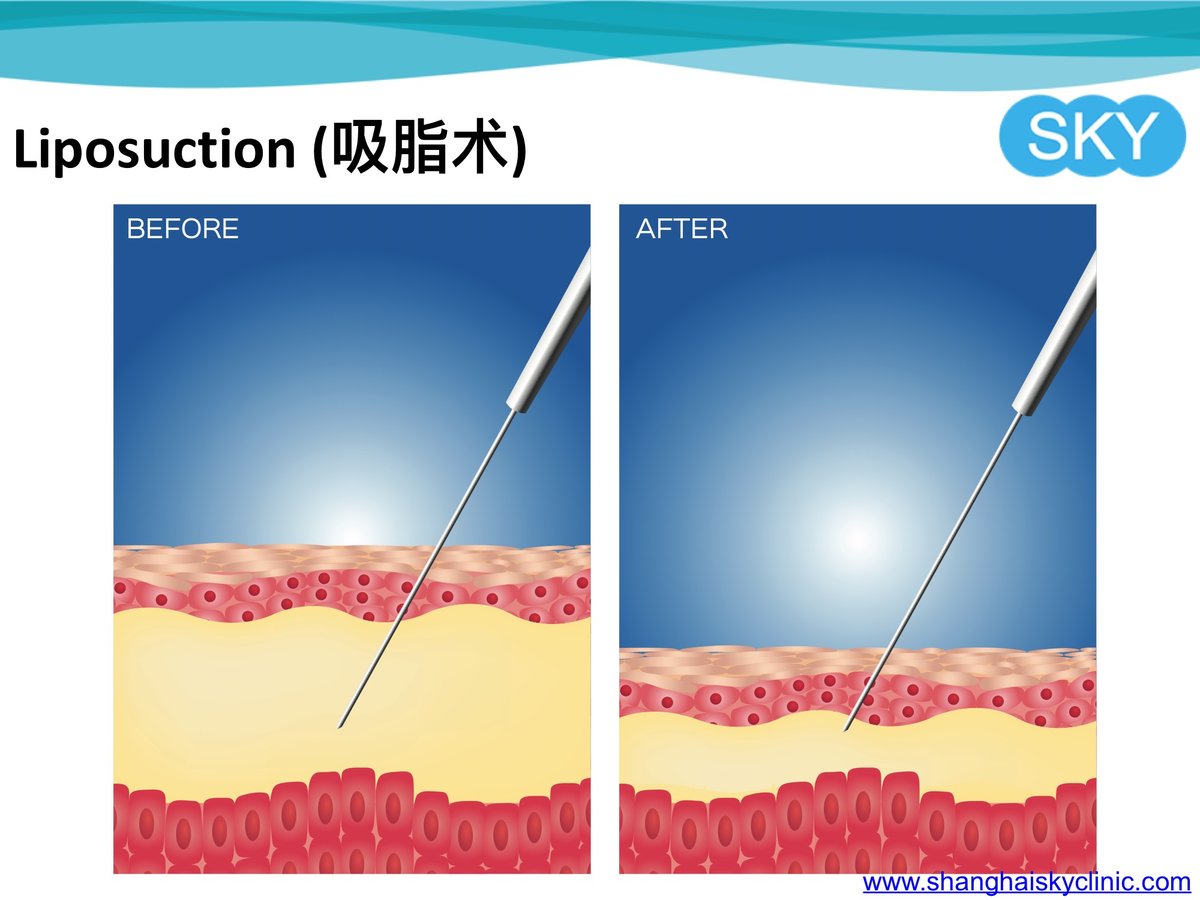 Shanghai Sky Clinic - Shanghai Sky Clinic