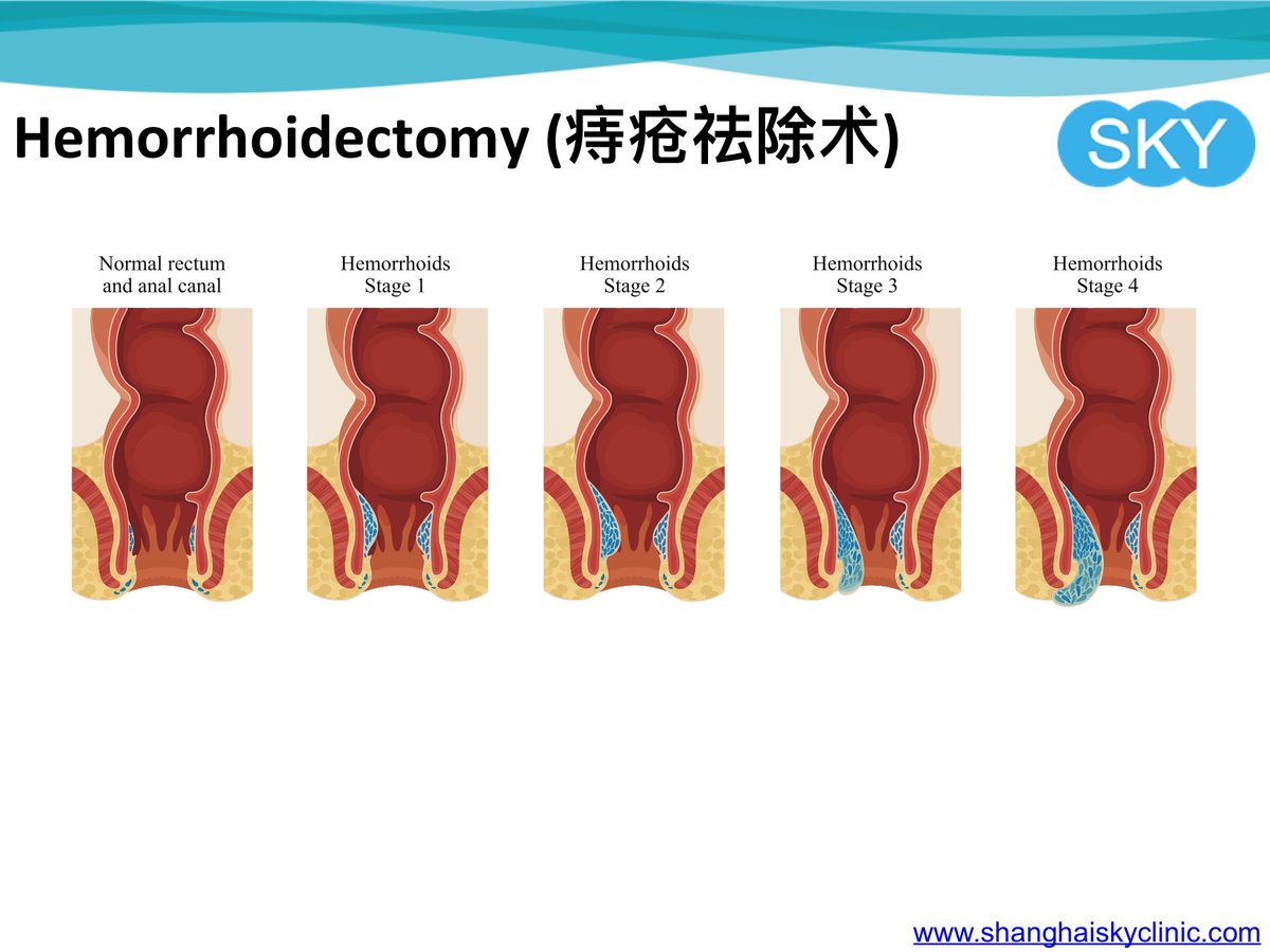 Shanghai Sky Clinic - Shanghai Sky Clinic
