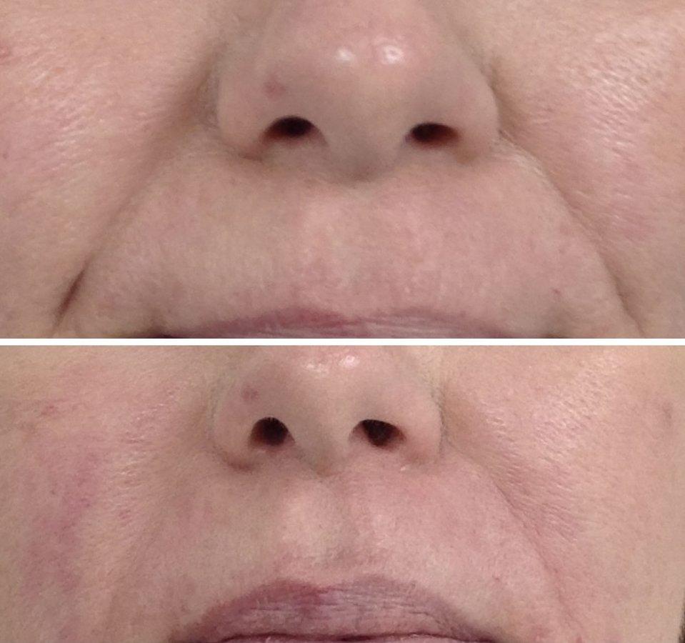 Sheffield Aesthetics & Laser Clinic - Sheffield Aesthetics & Laser Clinic