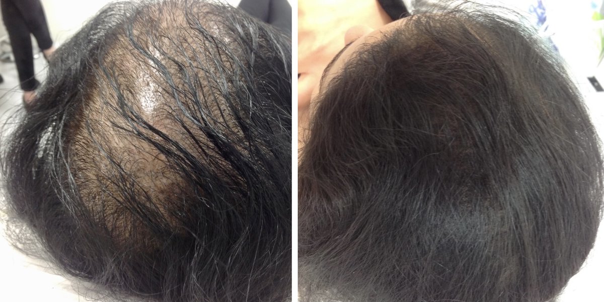 Sheffield Aesthetics & Laser Clinic - Sheffield Aesthetics & Laser Clinic