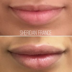Sheridan France - Harley Street - Sheridan France - Harley Street