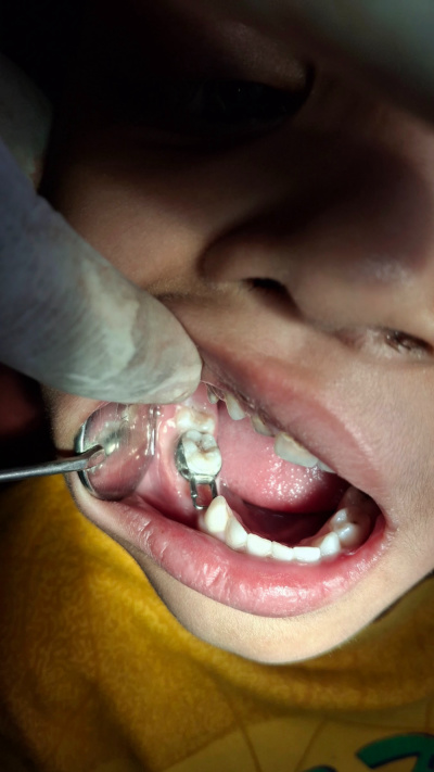 Shree Kids & Family Dental Clinic - Shree Kids & Family Dental Clinic