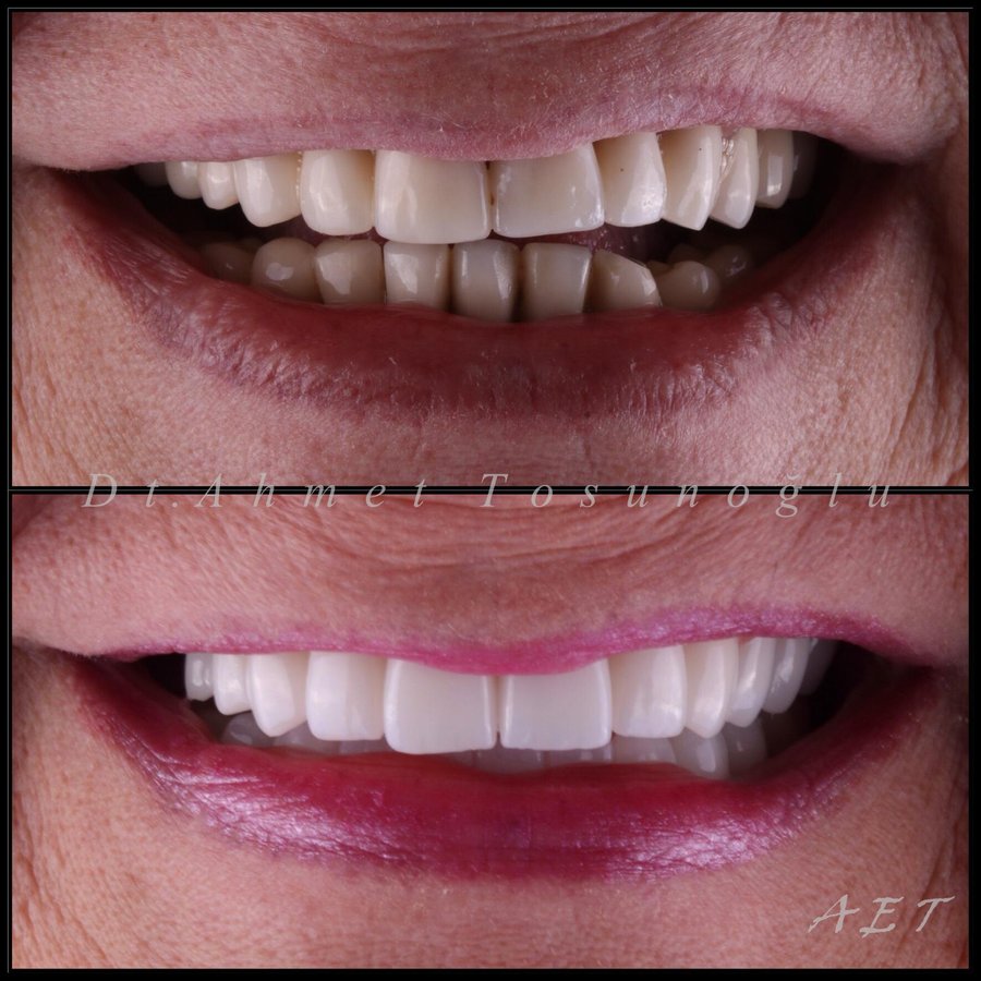 Side Dental Centre - Side Dental Centre