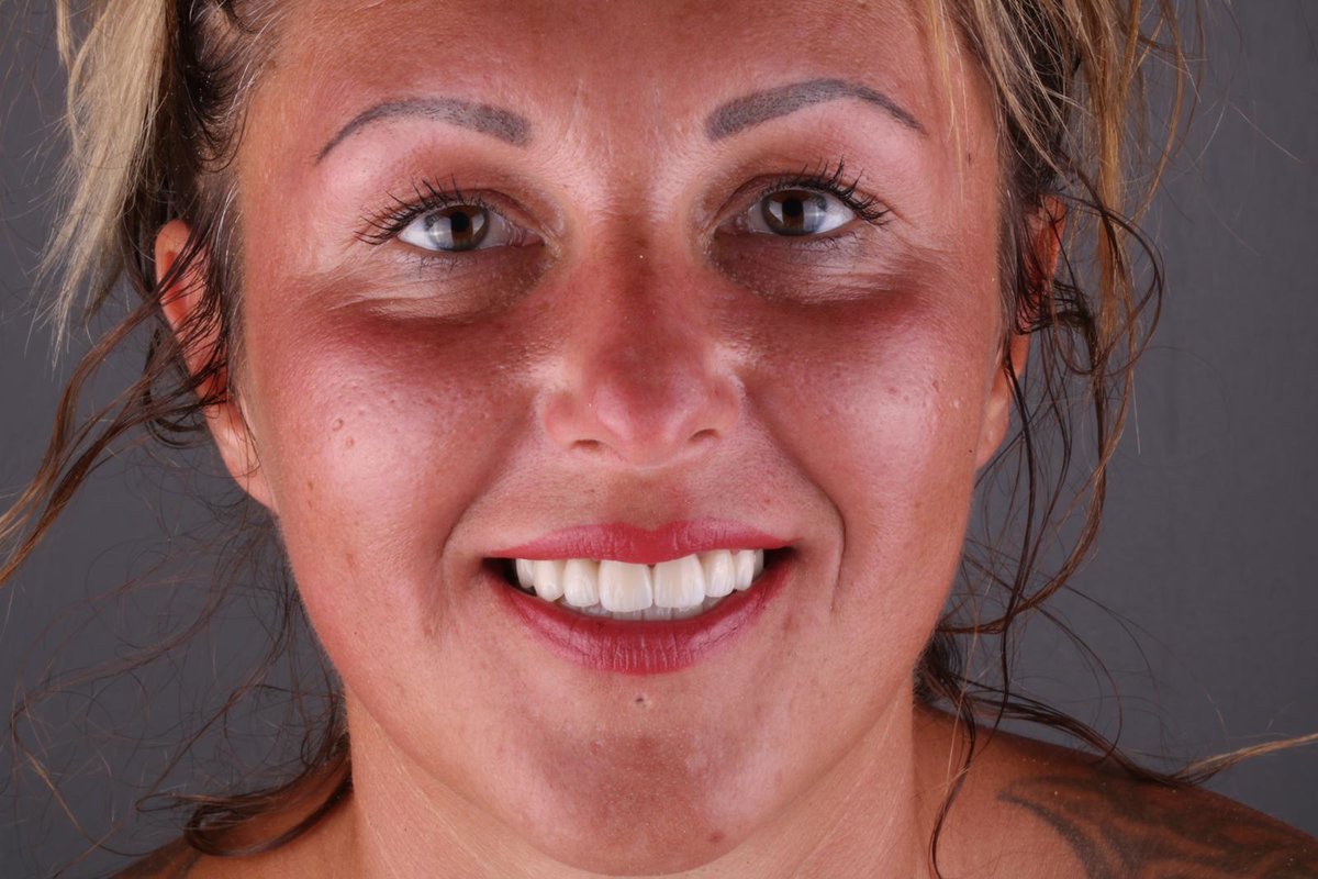 Side Dental Centre - Side Dental Centre