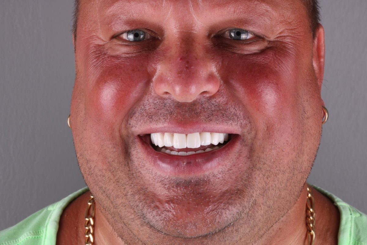 Side Dental Centre - Side Dental Centre