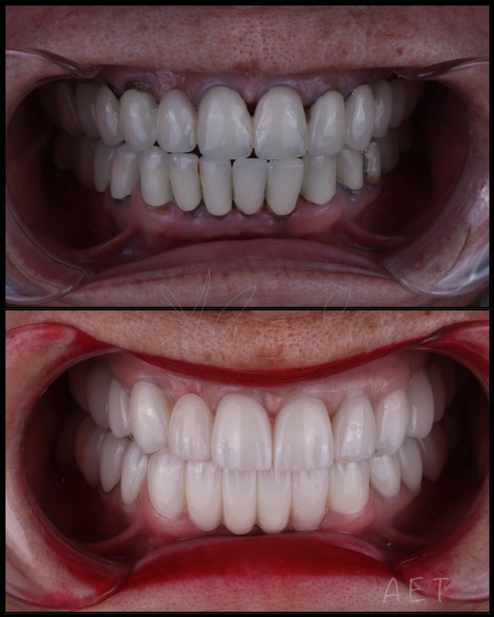 Side Dental Centre - Side Dental Centre