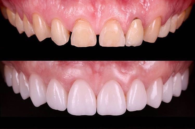 Side Dental Centre - Side Dental Centre