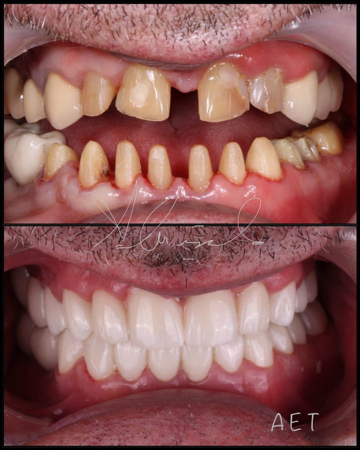 Side Dental Centre - Side Dental Centre