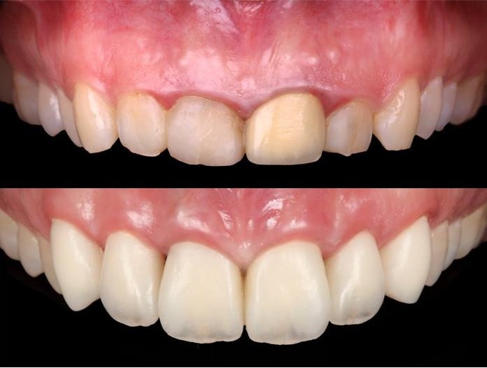 Side Dental Centre - Side Dental Centre