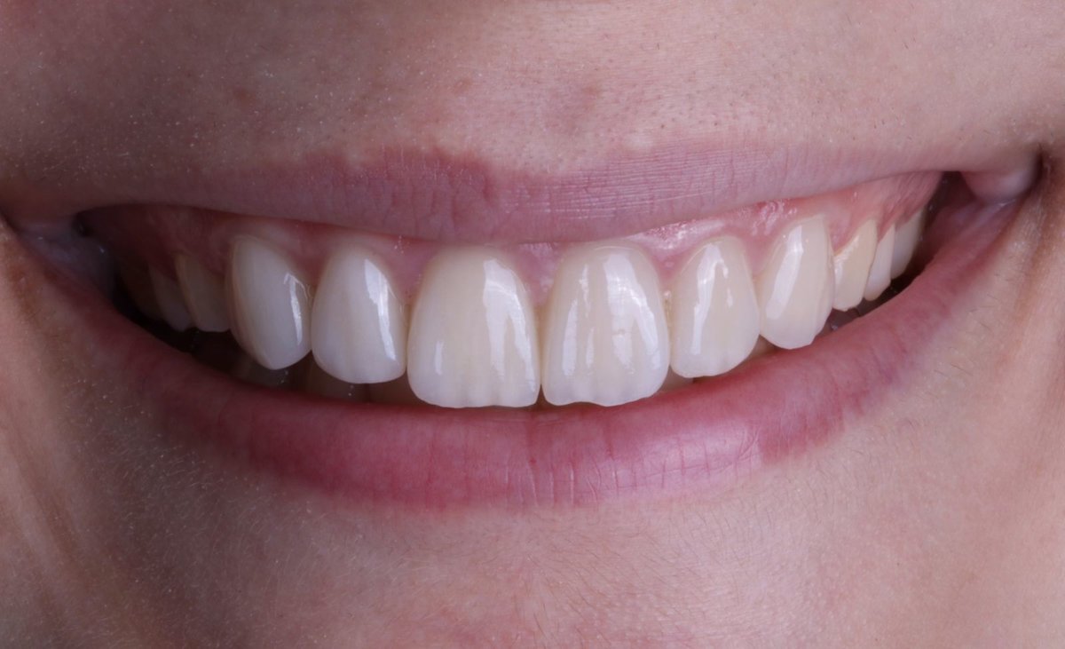 Side Dental Centre - Side Dental Centre