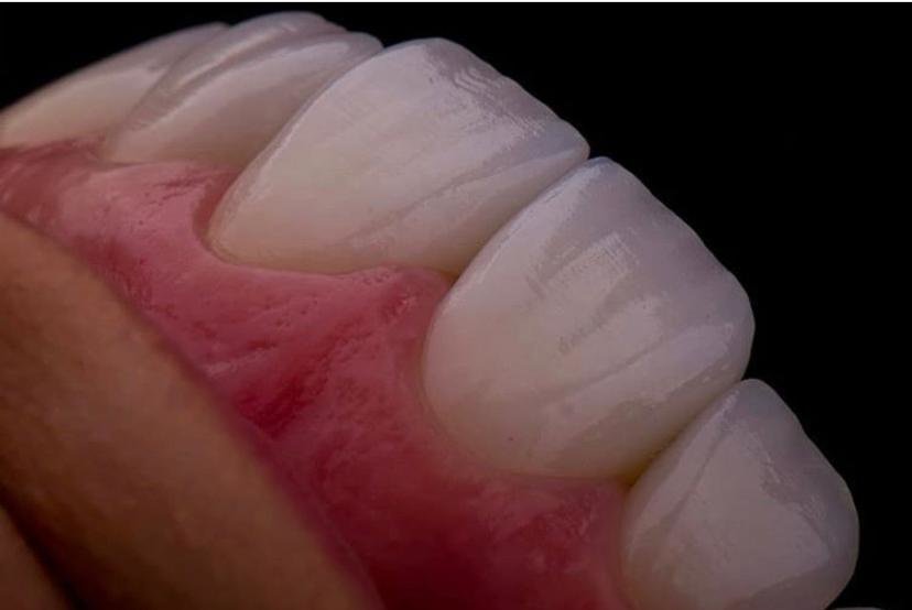 Side Dental Centre - Side Dental Centre