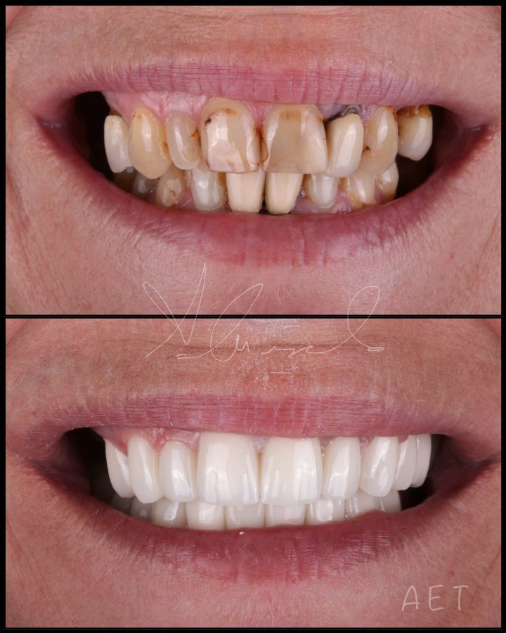 Side Dental Centre - Side Dental Centre