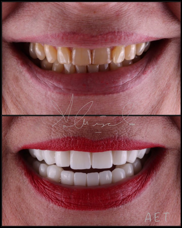 Side Dental Centre - Side Dental Centre