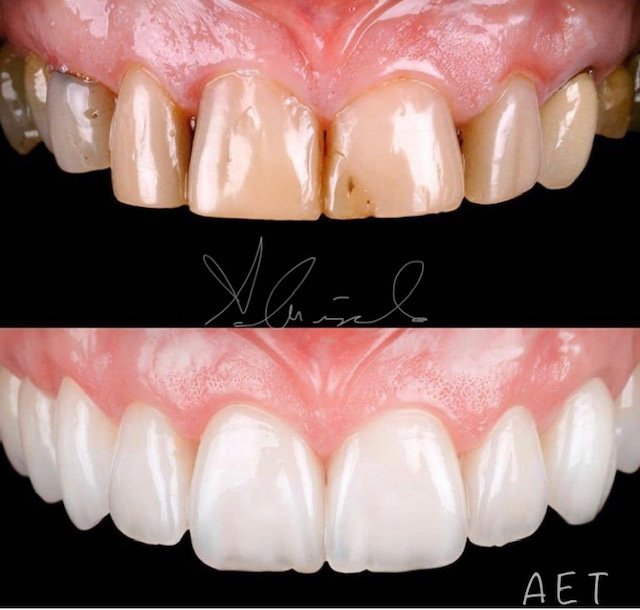 Side Dental Centre - Side Dental Centre