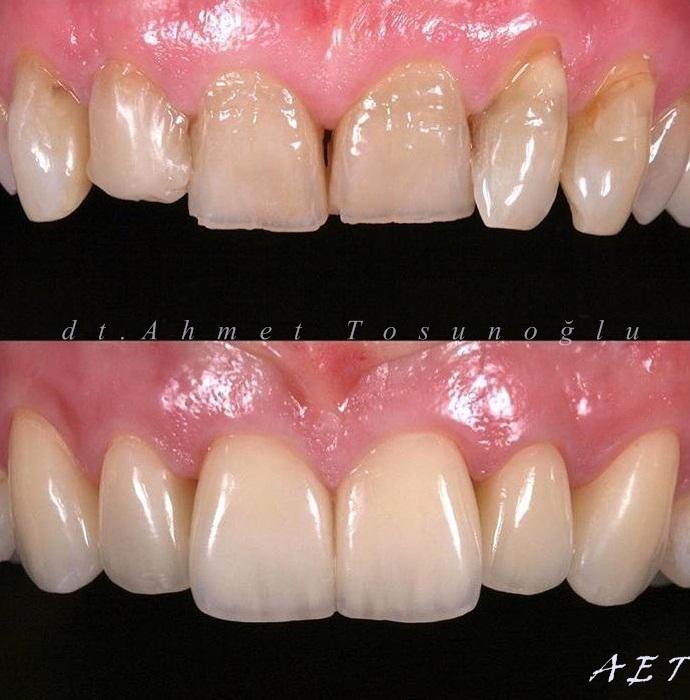 Side Dental Centre - Side Dental Centre