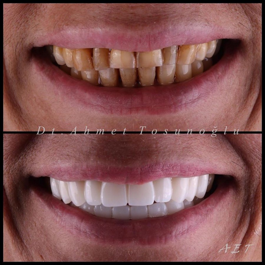 Side Dental Centre - Side Dental Centre