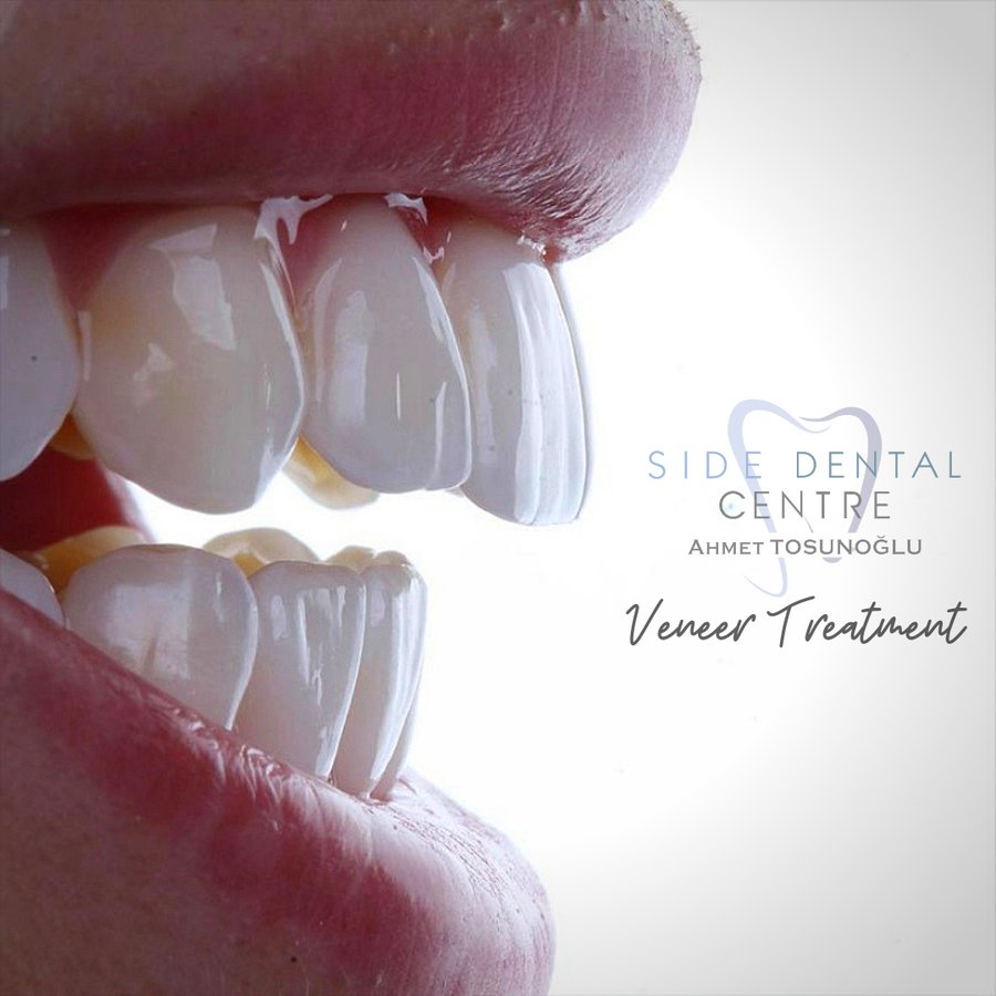 Side Dental Centre - Side Dental Centre