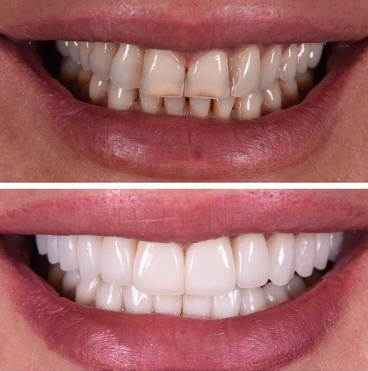 Side Dental Centre - Side Dental Centre