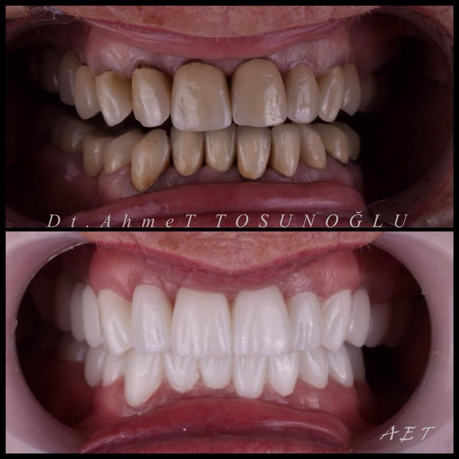 Side Dental Centre - Side Dental Centre