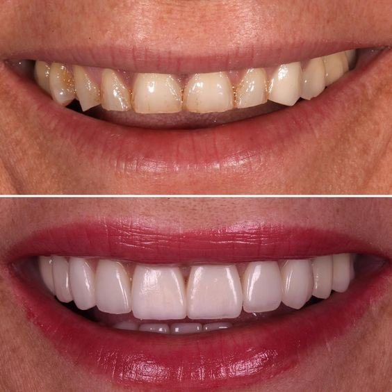 Side Dental Centre - Side Dental Centre