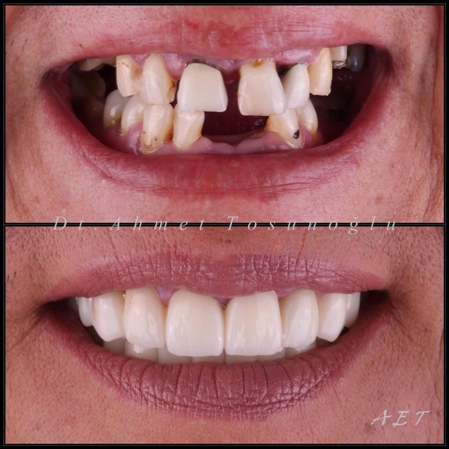 Side Dental Centre - Side Dental Centre