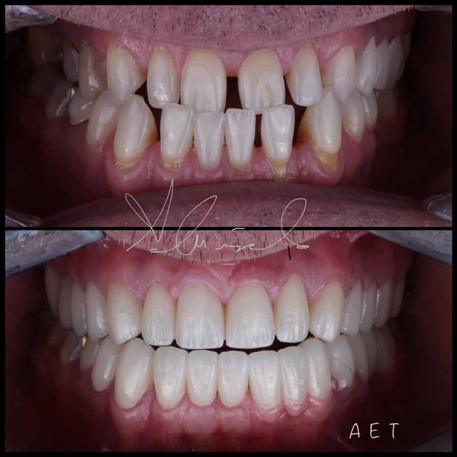 Side Dental Centre - Side Dental Centre