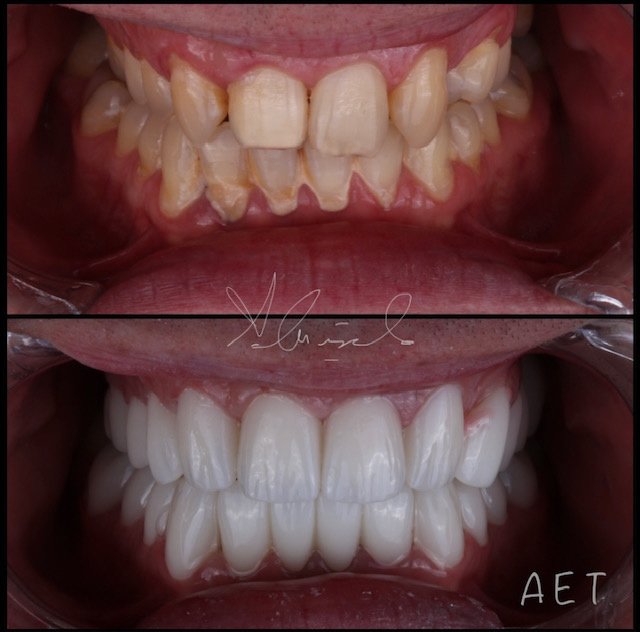 Side Dental Centre - Side Dental Centre