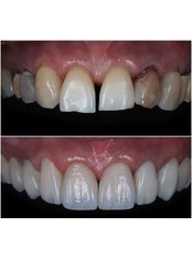 Side Dental Centre - Side Dental Centre