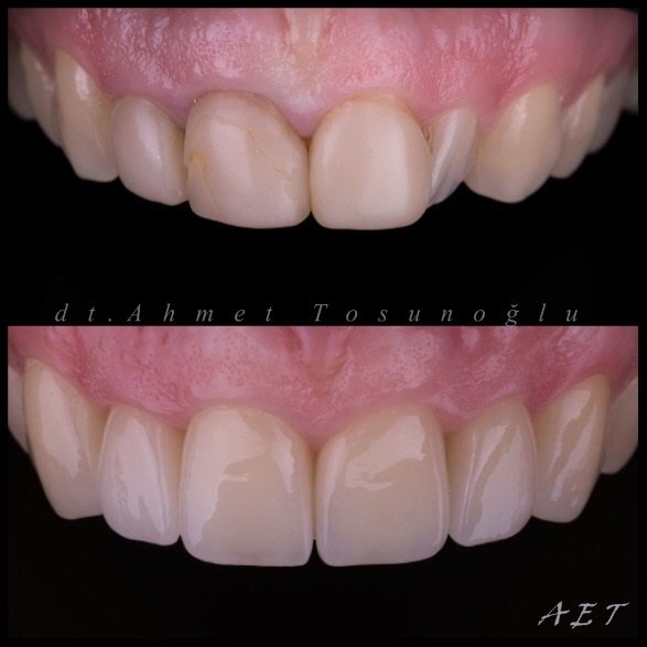 Side Dental Centre - Side Dental Centre