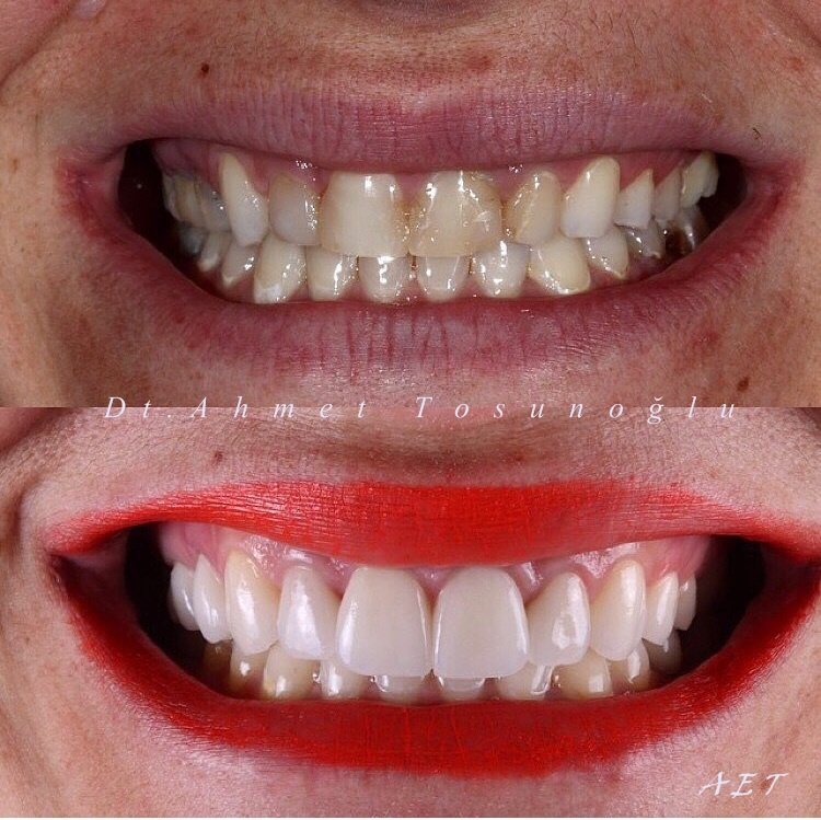 Side Dental Centre - Side Dental Centre